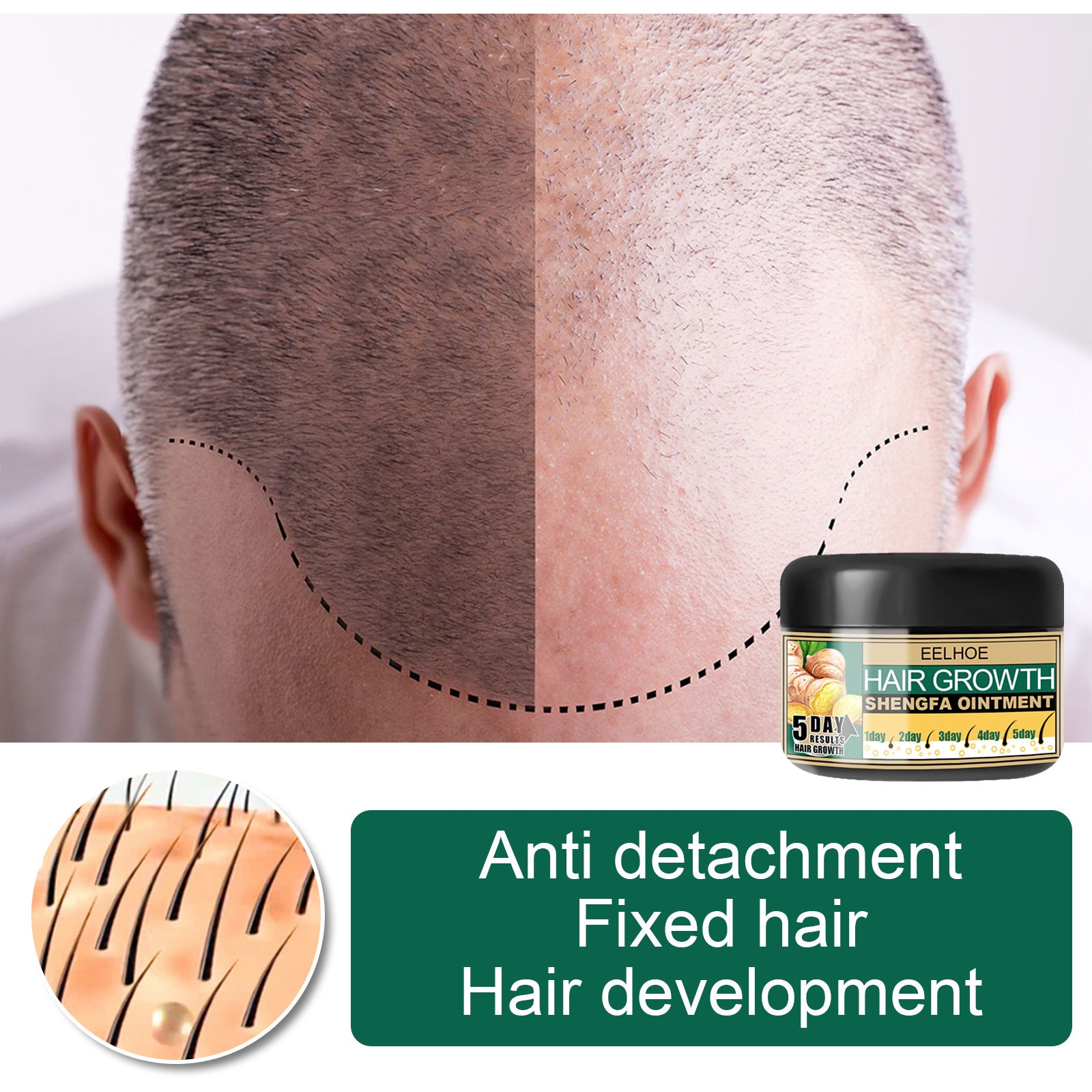 EELHOE Ginger Hair Growth Cream Antidandruff & Antipruritic Balm with collagen 30g