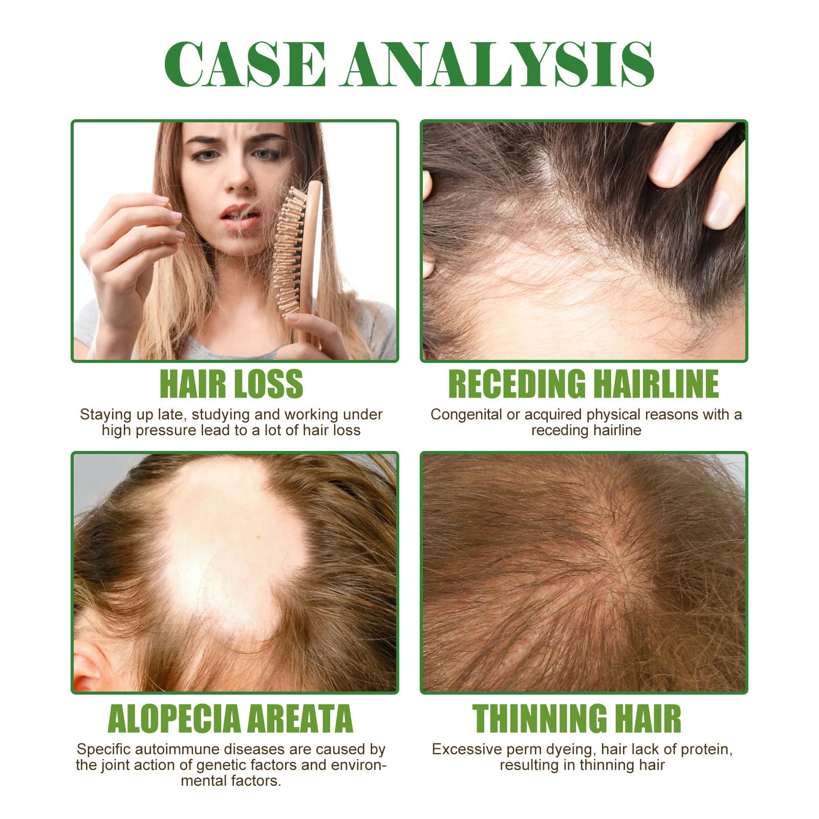 EELHOE Rosemary Oil Baby Hair Growth Essential Oil Repair & Damage Hair EELHOE COSMETICS