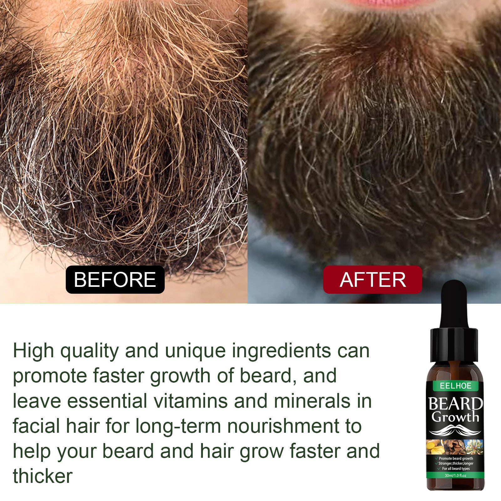 EELHOE Beard Growth Oil Mist Beard Care Intensive Treatment Oil