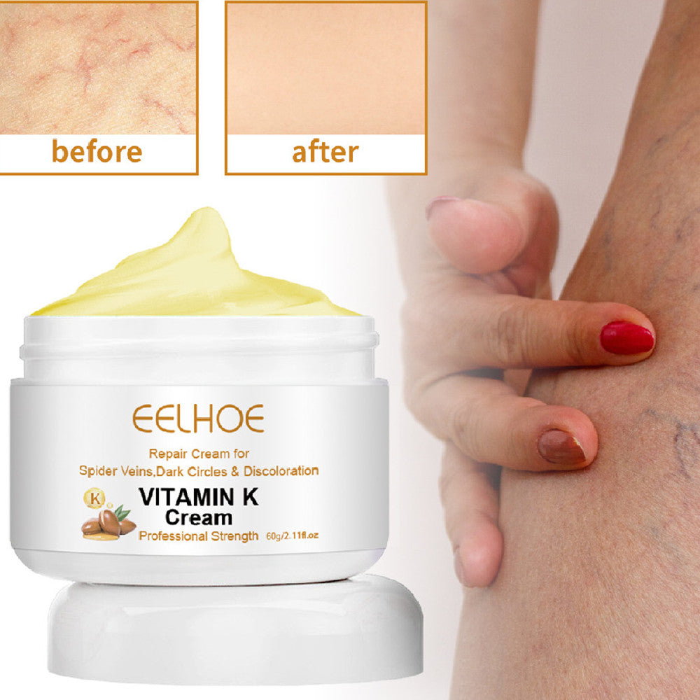 EELHOE Bulge & Swelling Of Legs Repair Cream EELHOE COSMETICS