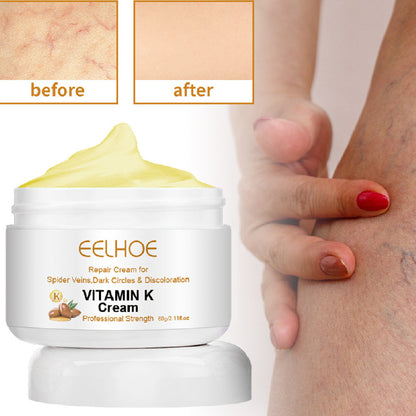 EELHOE Bulge & Swelling Of Legs Repair Cream EELHOE COSMETICS