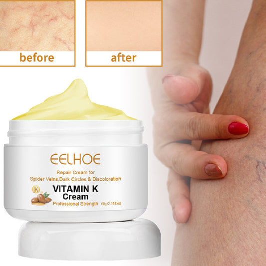 EELHOE Bulge & Swelling Of Legs Repair Cream EELHOE COSMETICS