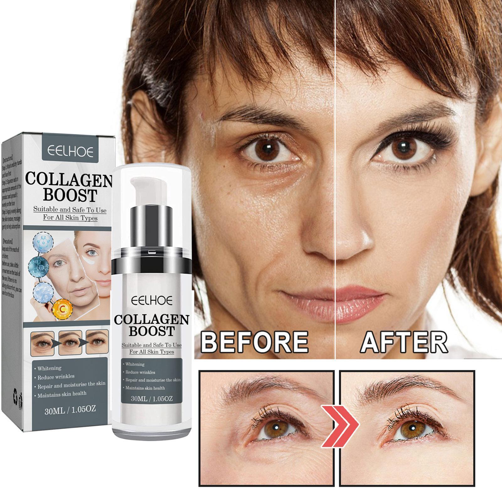 Eelhoe Collagen Boost Anti Wrinkle Cream Tightens Skin