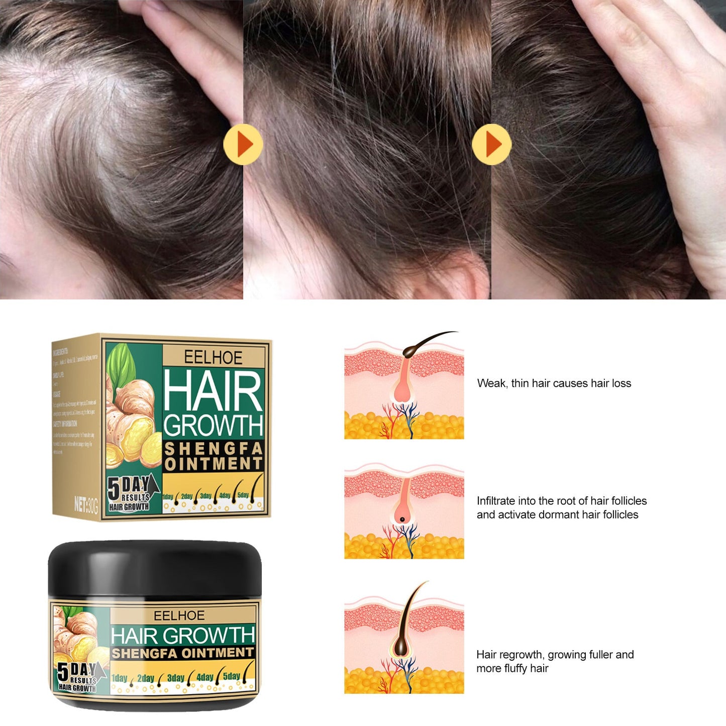 EELHOE Ginger Hair Growth Cream Antidandruff & Antipruritic Balm with collagen 30g EELHOE COSMETICS