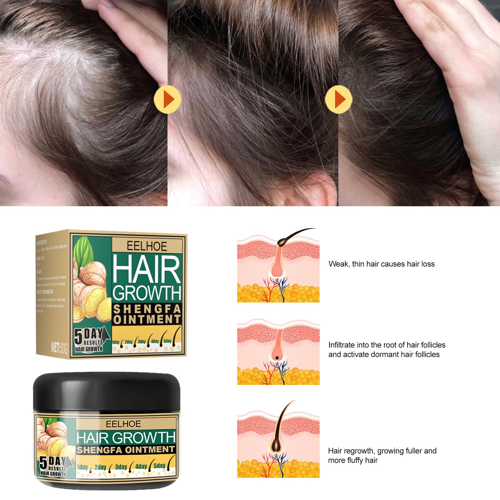 EELHOE Ginger Hair Growth Cream Antidandruff & Antipruritic Balm with collagen 30g