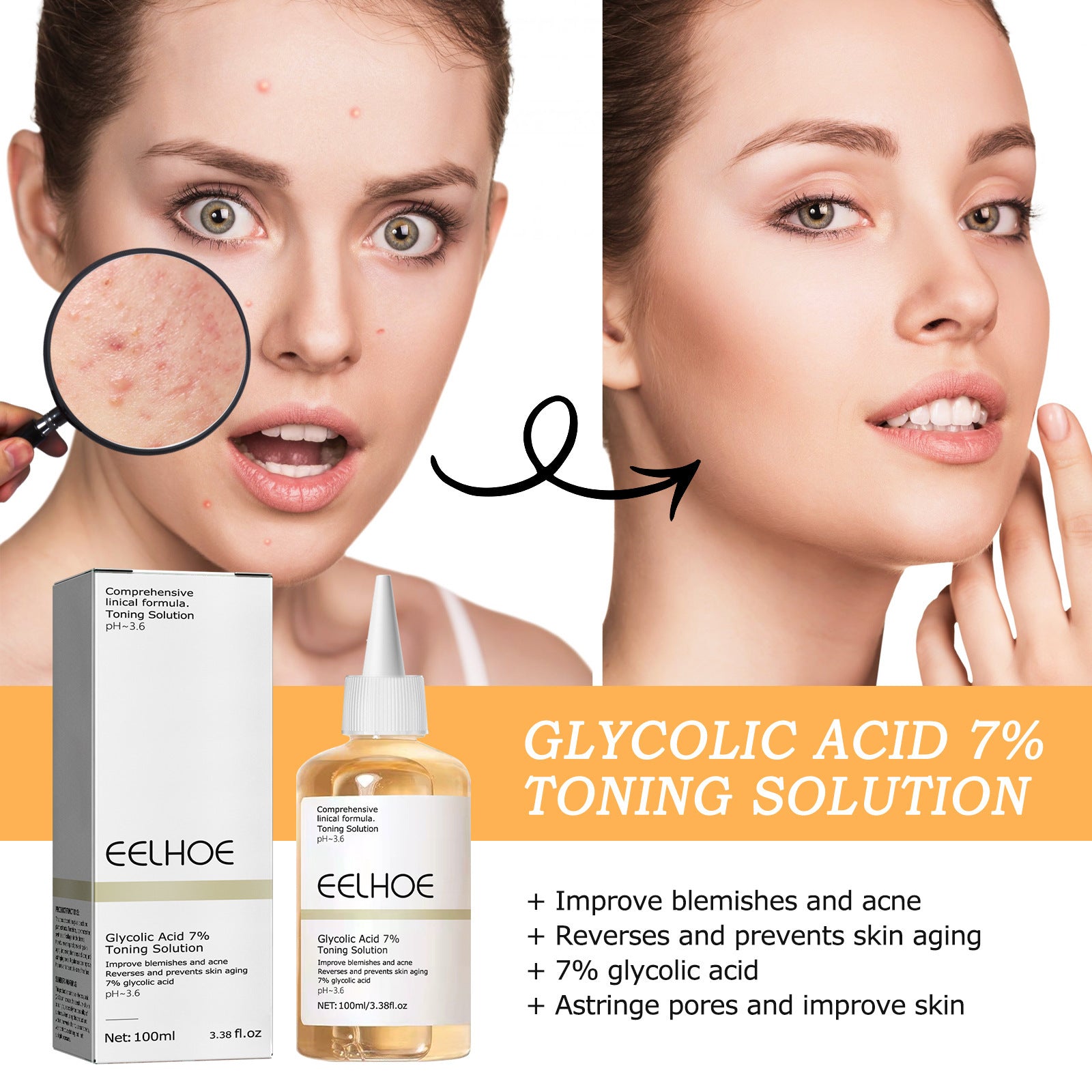 EELHOE Glycolic Acid 7% Toning Lotion Remove skin cutin & acne