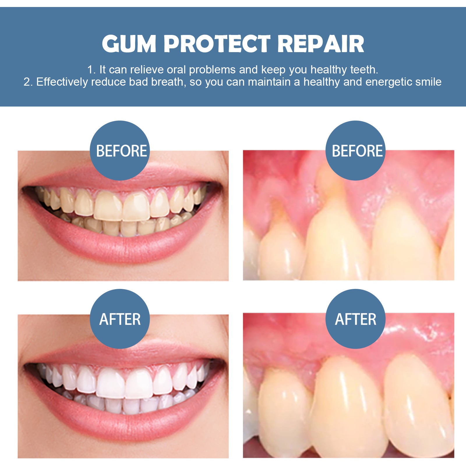 EELHOE Gum Repair Toothpaste Series Cleaning + Gum care gel repair drops