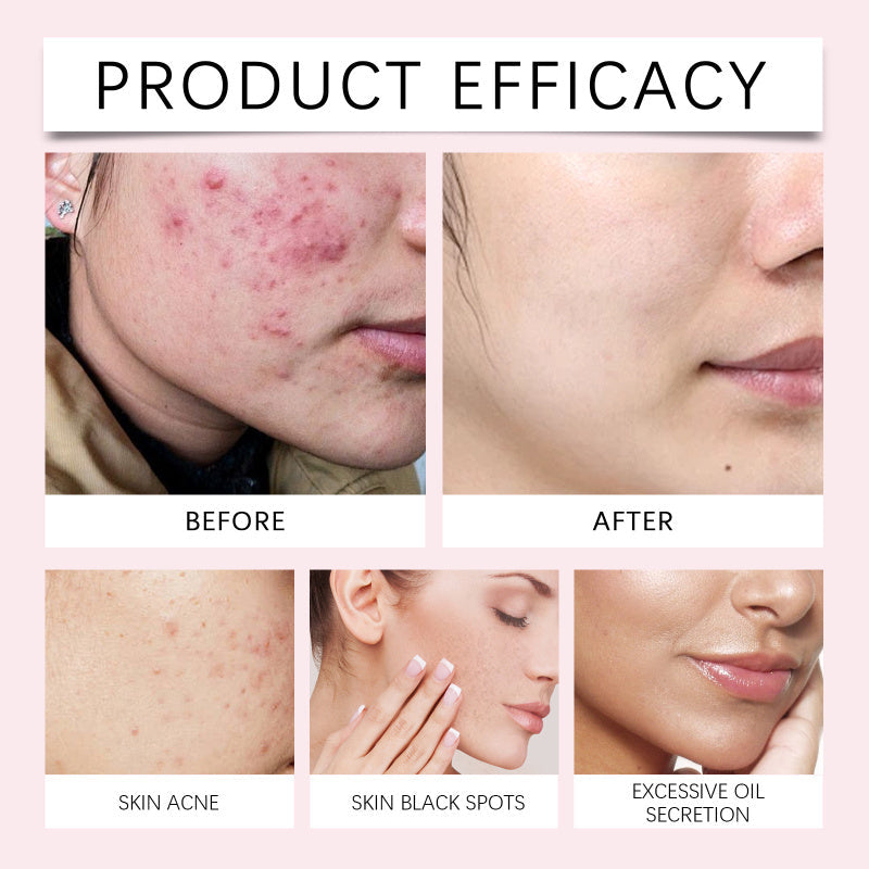 EELHOE Kojic acid and turmeric cleansing pads - Beauty EELHOE COSMETICS