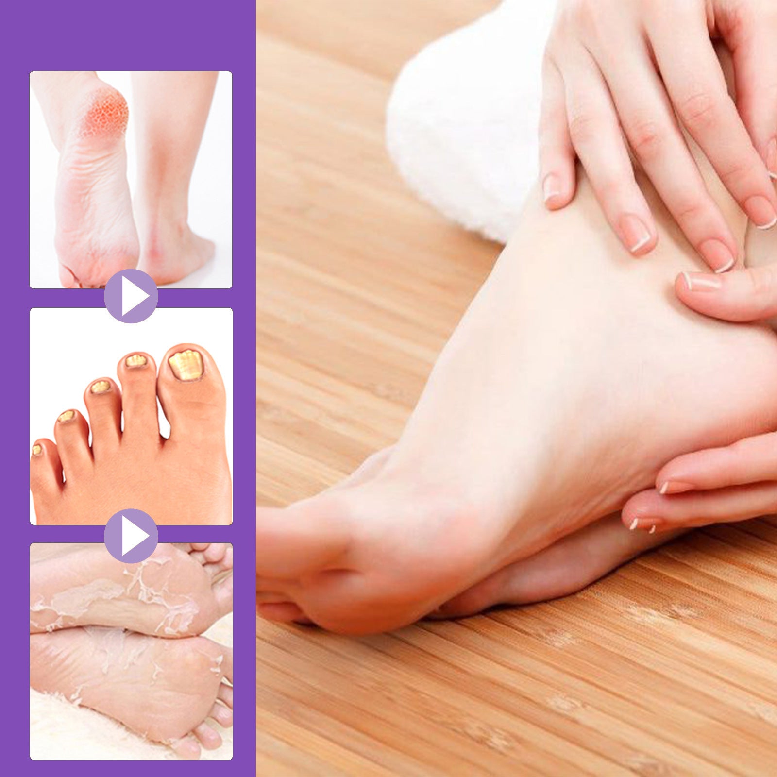 EELHOE Mask Foot Skin Chapped Exfoliating Skin Moisturizing And Nourishing Foot EELHOE COSMETICS