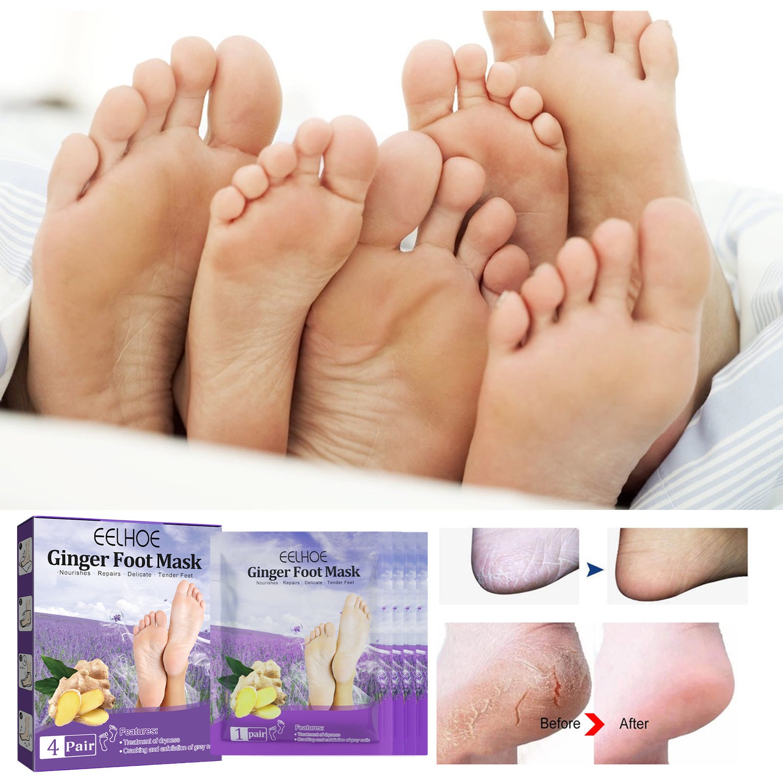 EELHOE Mask Foot Skin Chapped Exfoliating Skin Moisturizing And Nourishing Foot