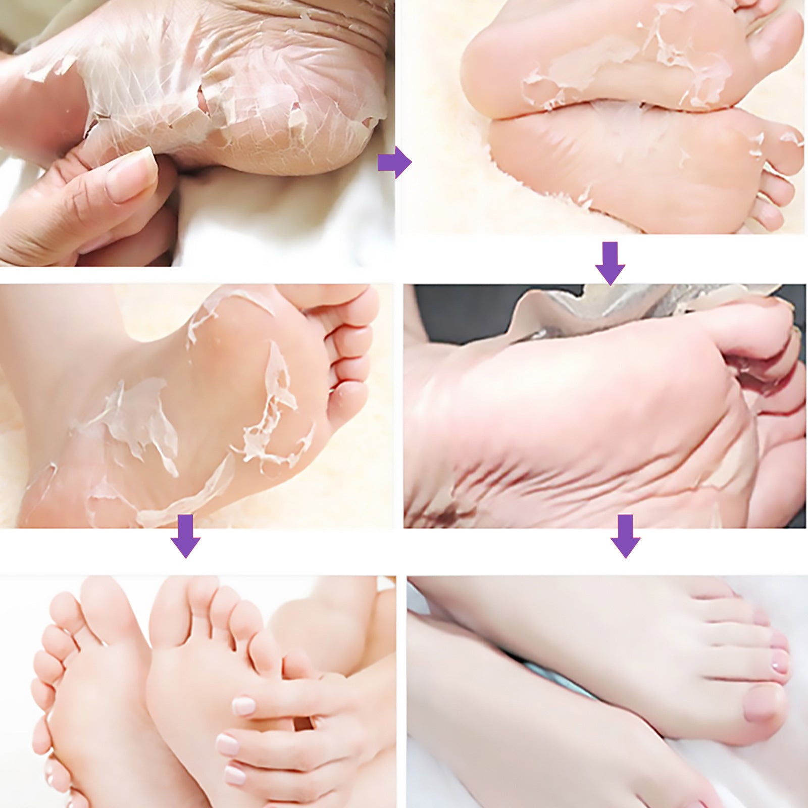 EELHOE Mask Foot Skin Chapped Exfoliating Skin Moisturizing And Nourishing Foot