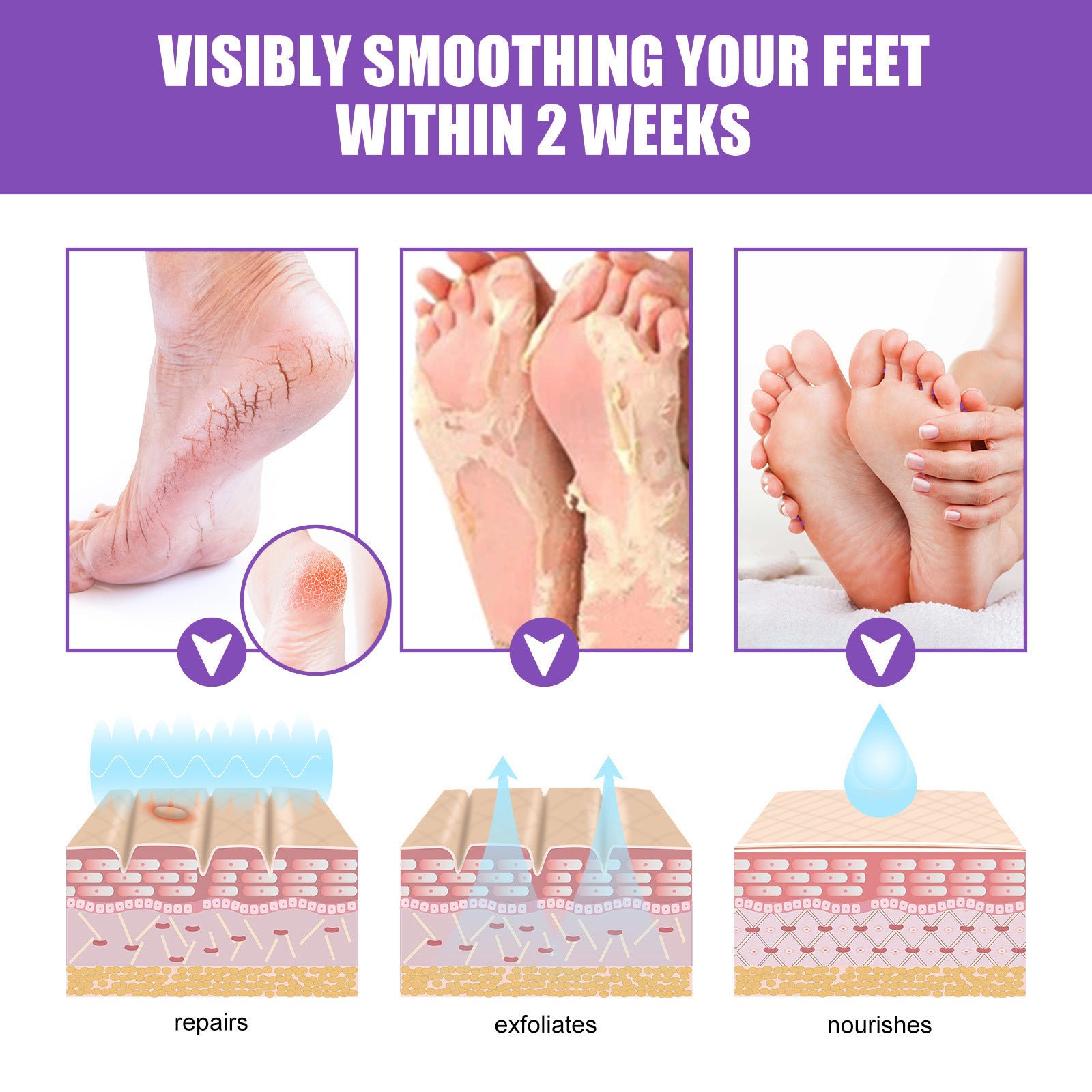 EELHOE Mask Foot Skin Chapped Exfoliating Skin Moisturizing And Nourishing Foot EELHOE COSMETICS