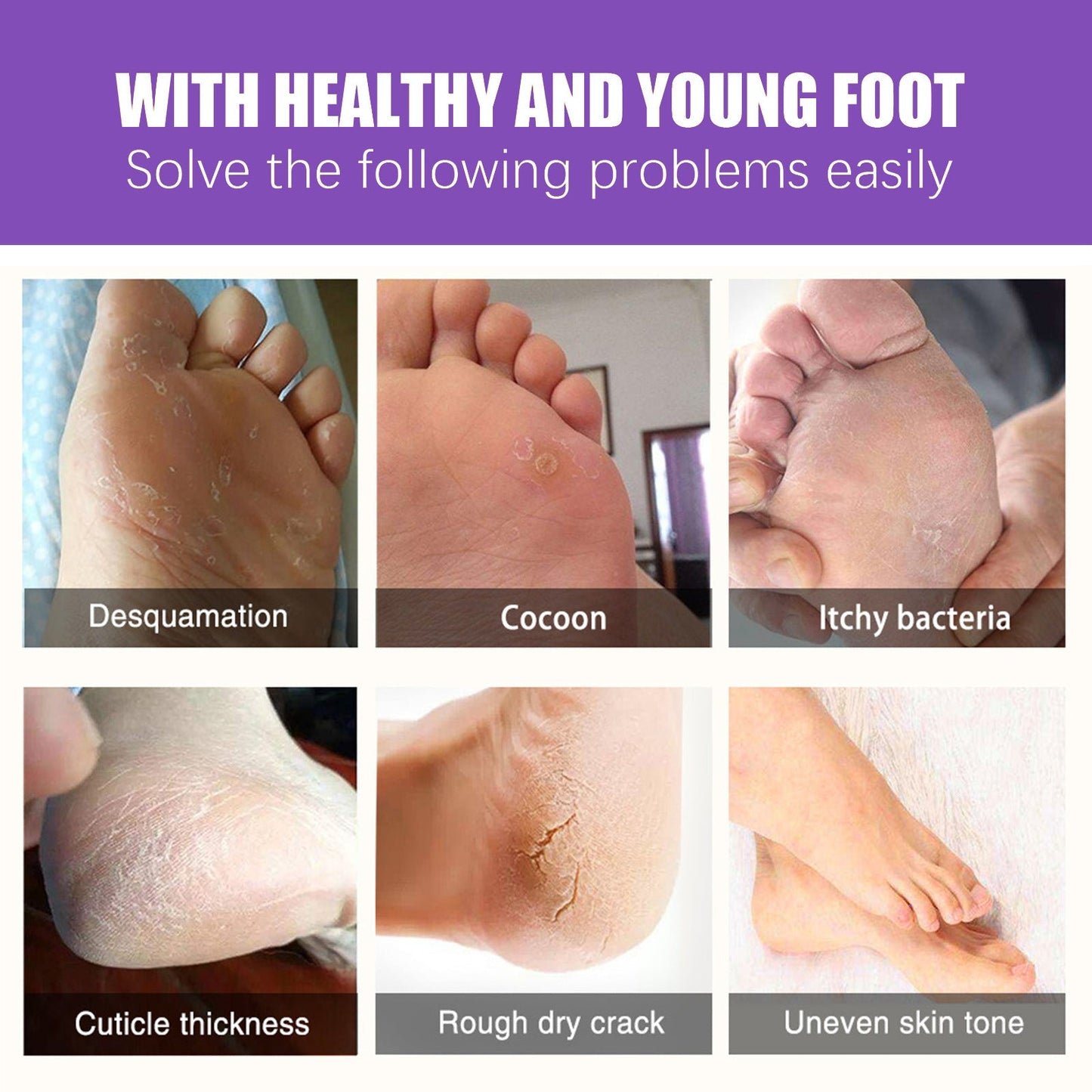 EELHOE Mask Foot Skin Chapped Exfoliating Skin Moisturizing And Nourishing Foot EELHOE COSMETICS