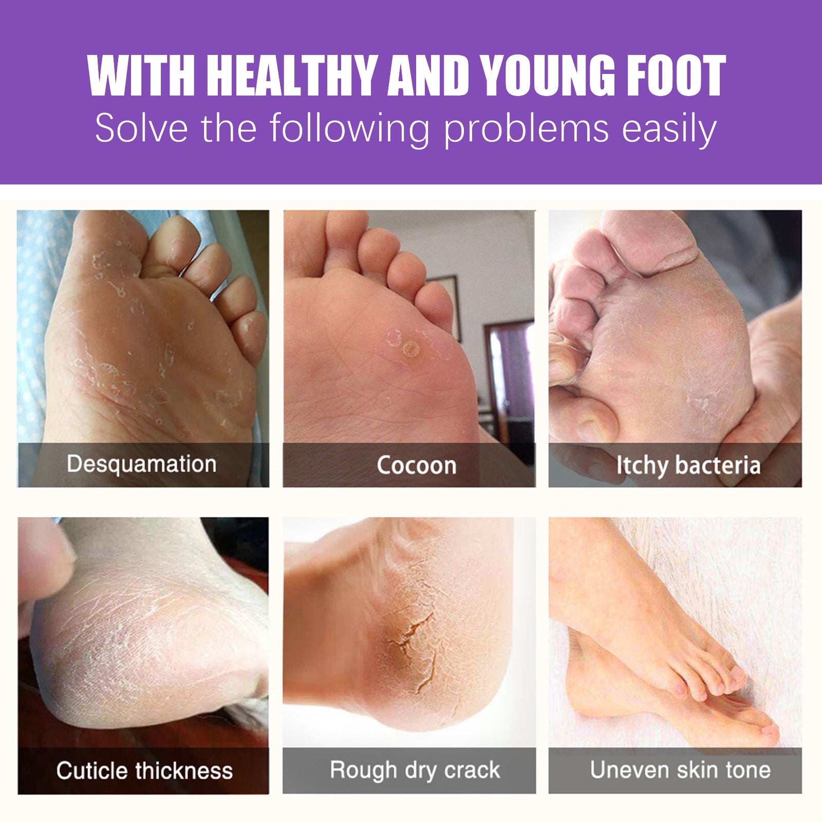 EELHOE Mask Foot Skin Chapped Exfoliating Skin Moisturizing And Nourishing Foot EELHOE COSMETICS