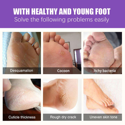 EELHOE Mask Foot Skin Chapped Exfoliating Skin Moisturizing And Nourishing Foot EELHOE COSMETICS