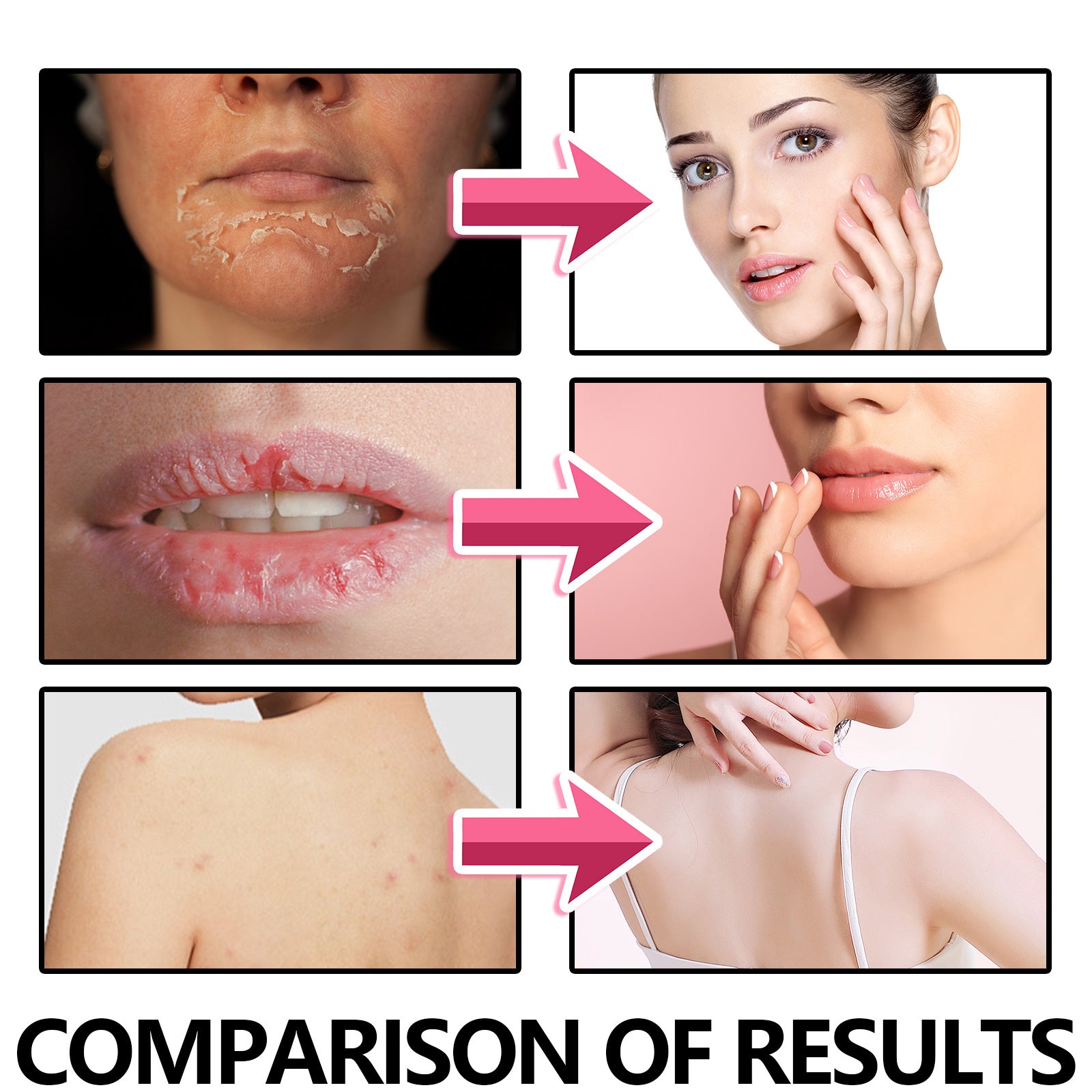 EELHOE Moisturizing Lip scrub - Exfoliating Facial - Body scrub Exfoliating EELHOE COSMETICS