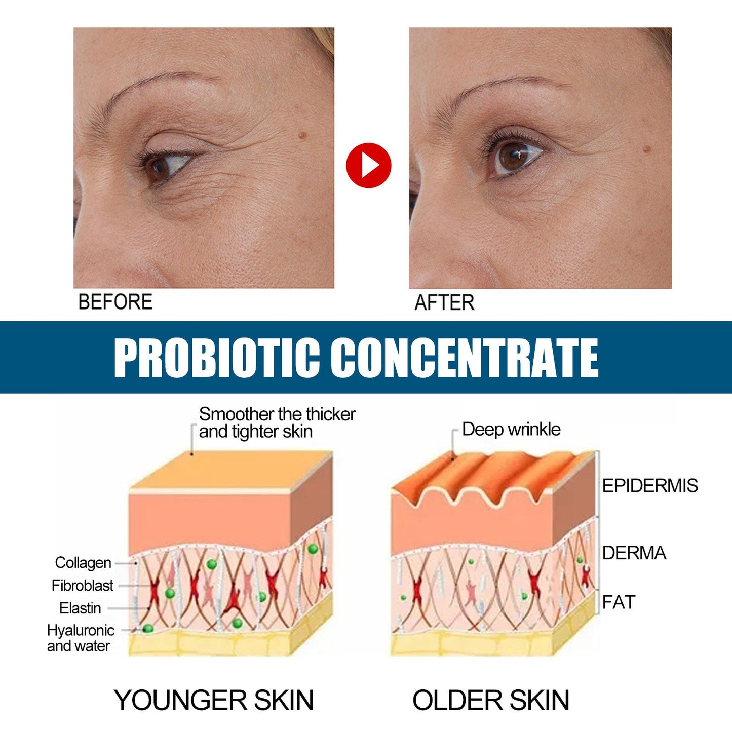 EELHOE Probiotics Concentrated Anti-wrinkle Serum Hydrating And Firming EELHOE COSMETICS
