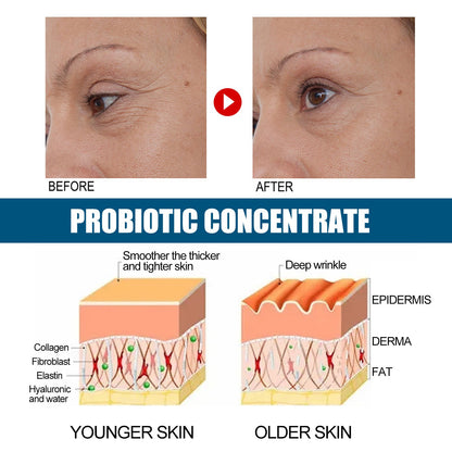 EELHOE Probiotics Concentrated Anti-wrinkle Serum Hydrating And Firming EELHOE COSMETICS