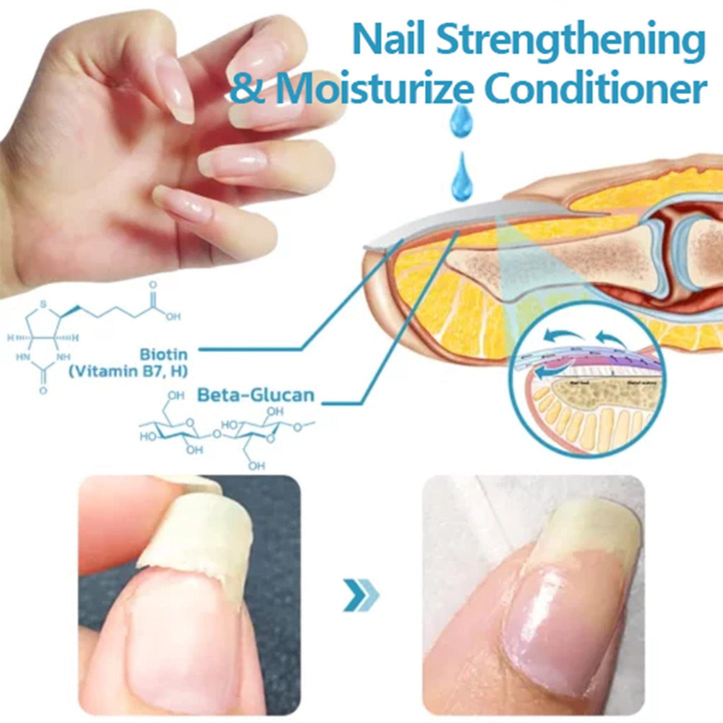 Eelhoe Repair Hand And Foot Cleaning Nail Brightening Care Solution - EELHOE COSMETICS