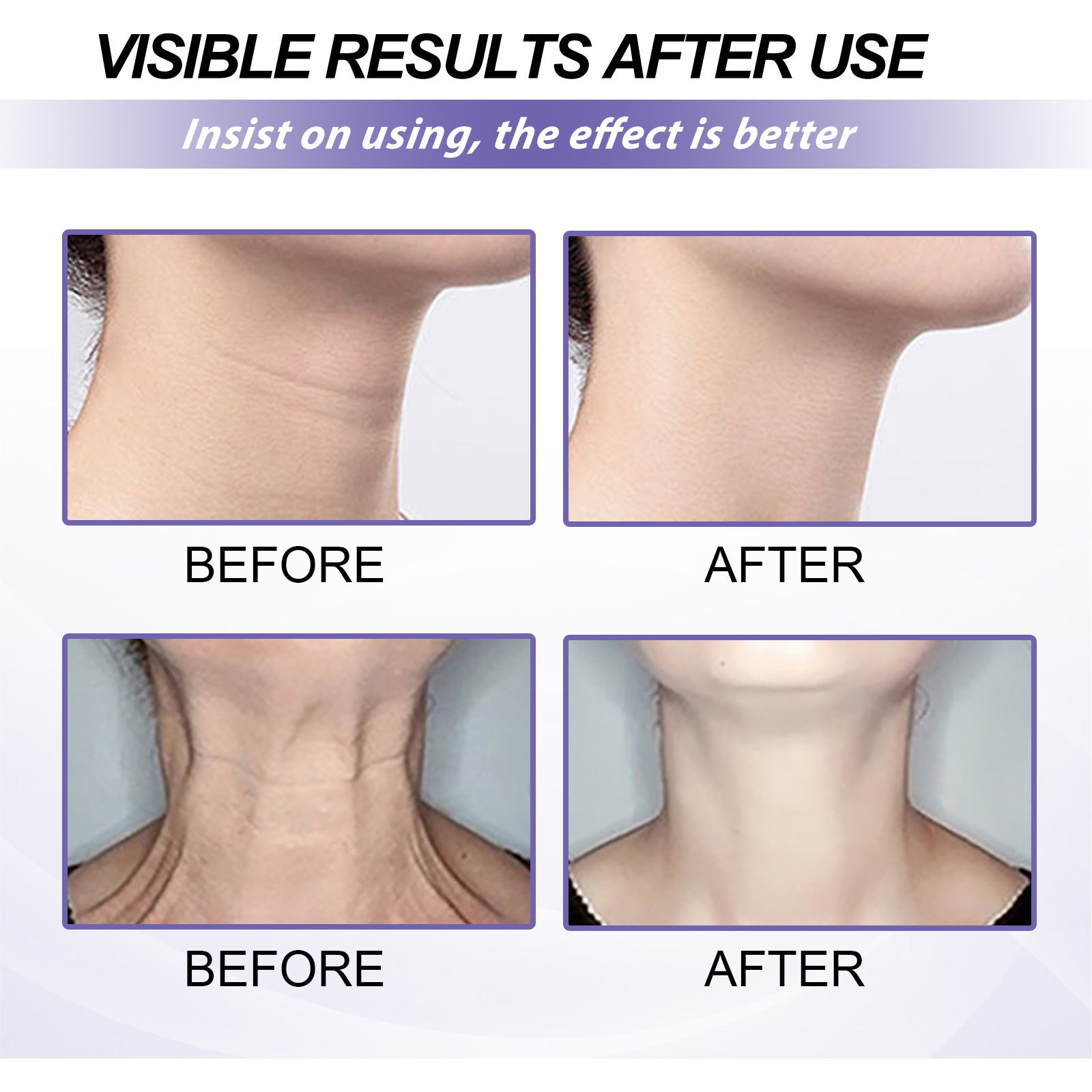 EELHOE Retinol for neck lines Cream Nourishing And Firming Neck Skin Reshaping EELHOE COSMETICS