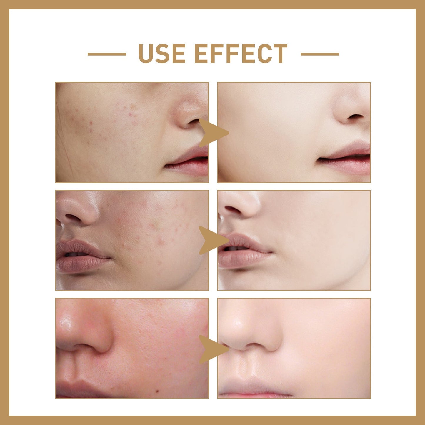 EELHOE Rice toner Lotion Deep Hydrating Repair Skin Barrier EELHOE COSMETICS