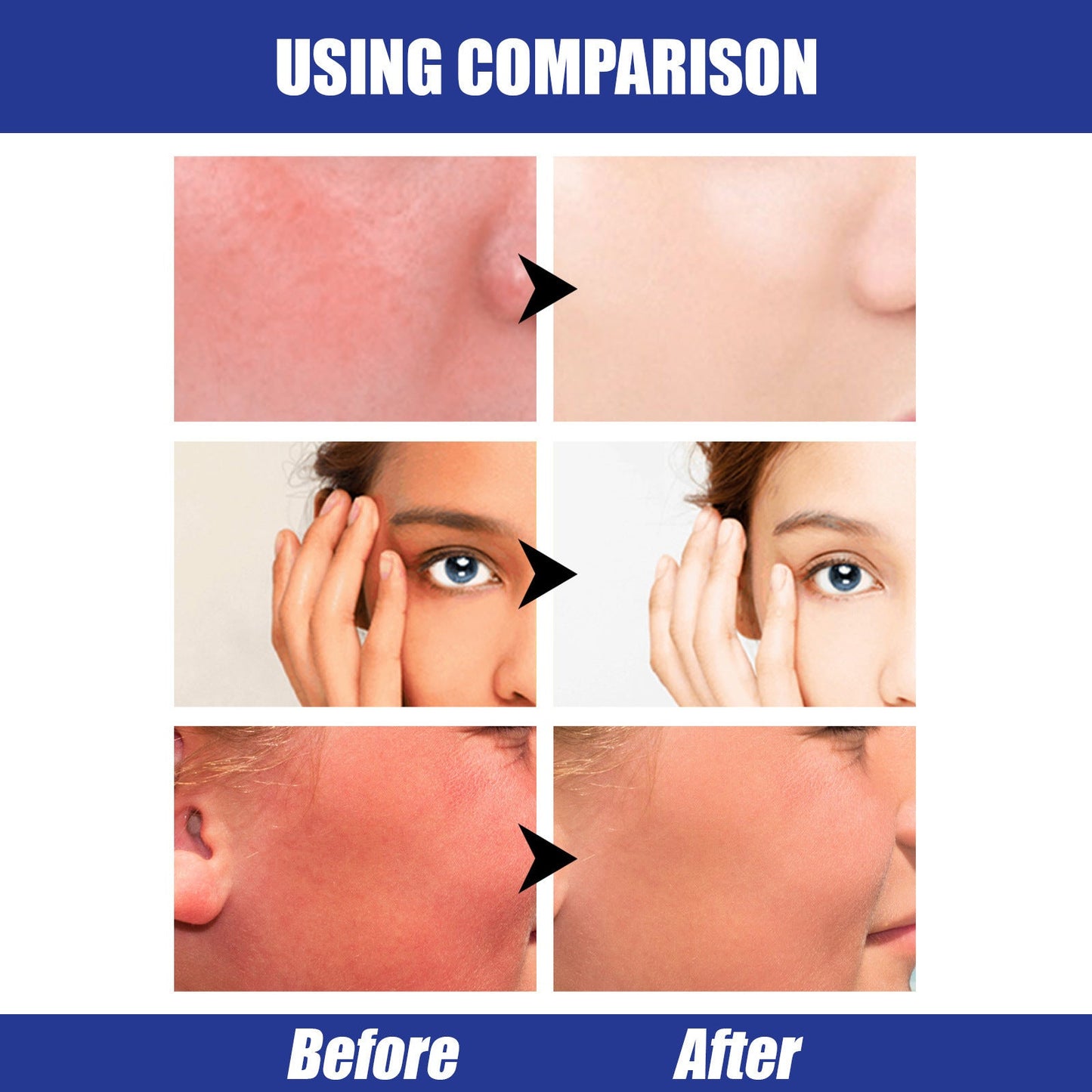 Eelhoe Waterproof SPF50 Hyaluronic Acid Sun Block Stick EELHOE COSMETICS