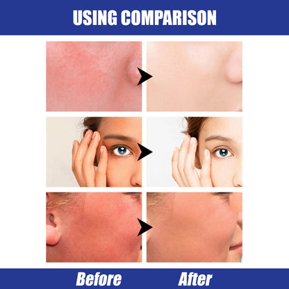 Eelhoe Waterproof SPF50 Hyaluronic Acid Sun Block Stick EELHOE COSMETICS