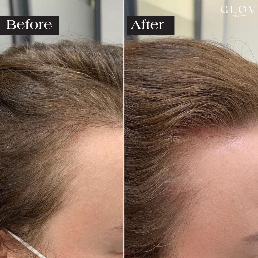 EELHOE Scalp Care Serum with Microneedle Applicator EELHOE COSMETICS