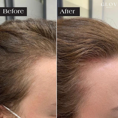 EELHOE Scalp Care Serum with Microneedle Applicator EELHOE COSMETICS