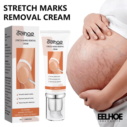 EELHOE Anti Stretch Mark oil for Postpartum and Obesity 45g EELHOE COSMETICS