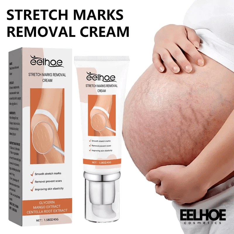 EELHOE Anti Stretch Mark oil for Postpartum and Obesity 45g