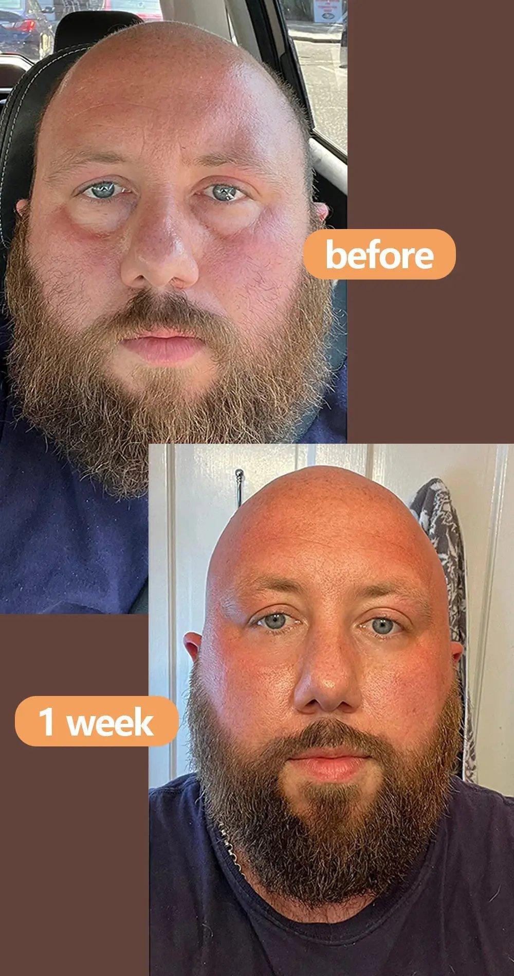 EELHOE Eye cream Dark Circles & Anti pufiness EELHOE COSMETICS