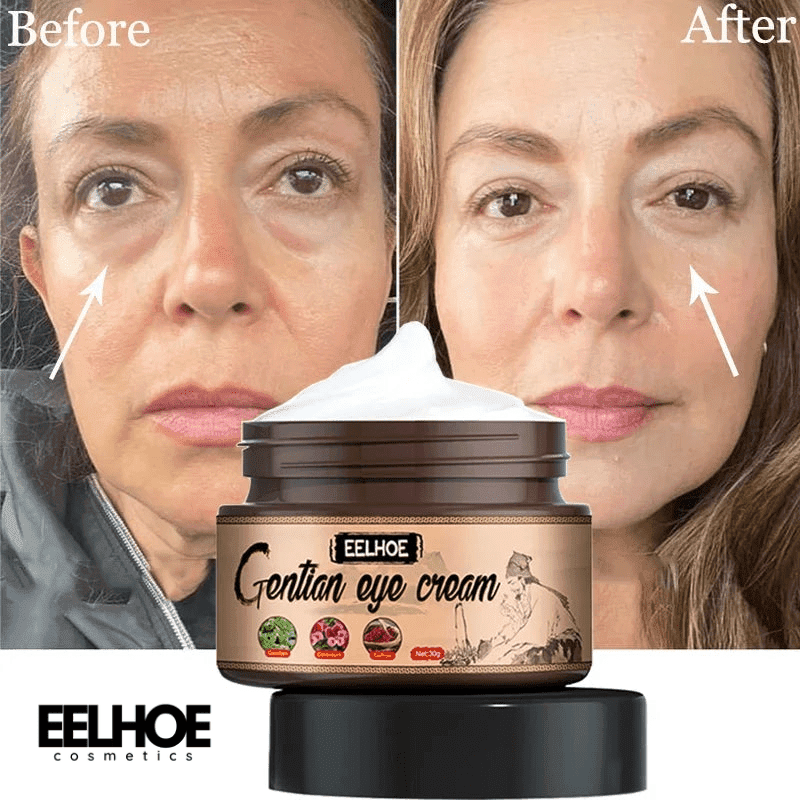 EELHOE Eye Cream Remove Eye Bags Dark Circle Particles Moisturizing