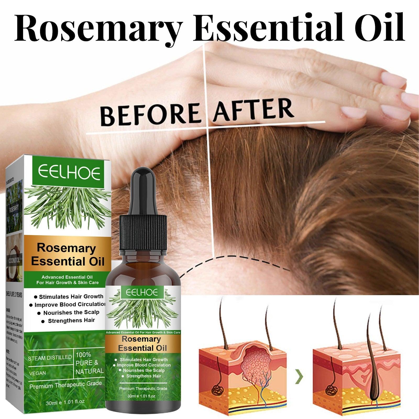 EELHOE Hair Growth + Anti-Breakage Rosemary Essential Oil Hair 30ML