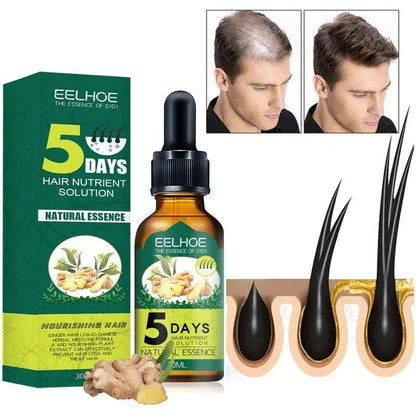 EELHOE Hair oil regrowth Ginger Essential Oil for Alopecia and Hair Loss (30ml) EELHOE COSMETICS