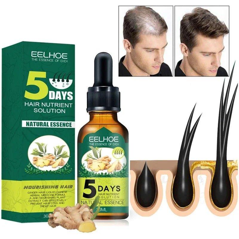 EELHOE Hair oil regrowth Ginger Essential Oil for Alopecia and Hair Loss (30ml)