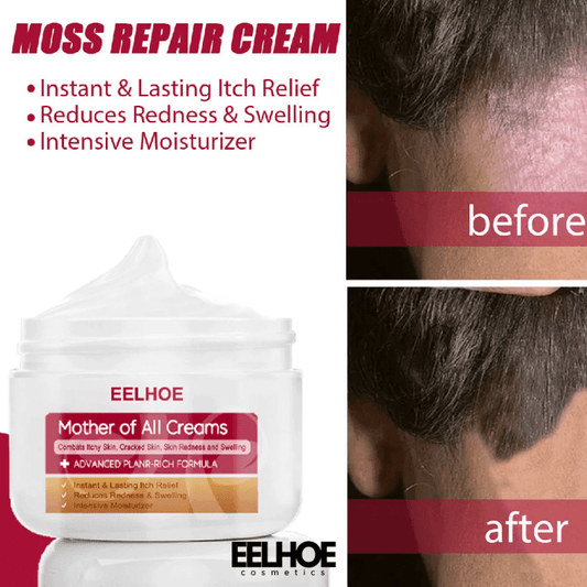 EELHOE Repair Cream Relieve Itching Body , Hands And Feet 50g 50 G EELHOE COSMETICS