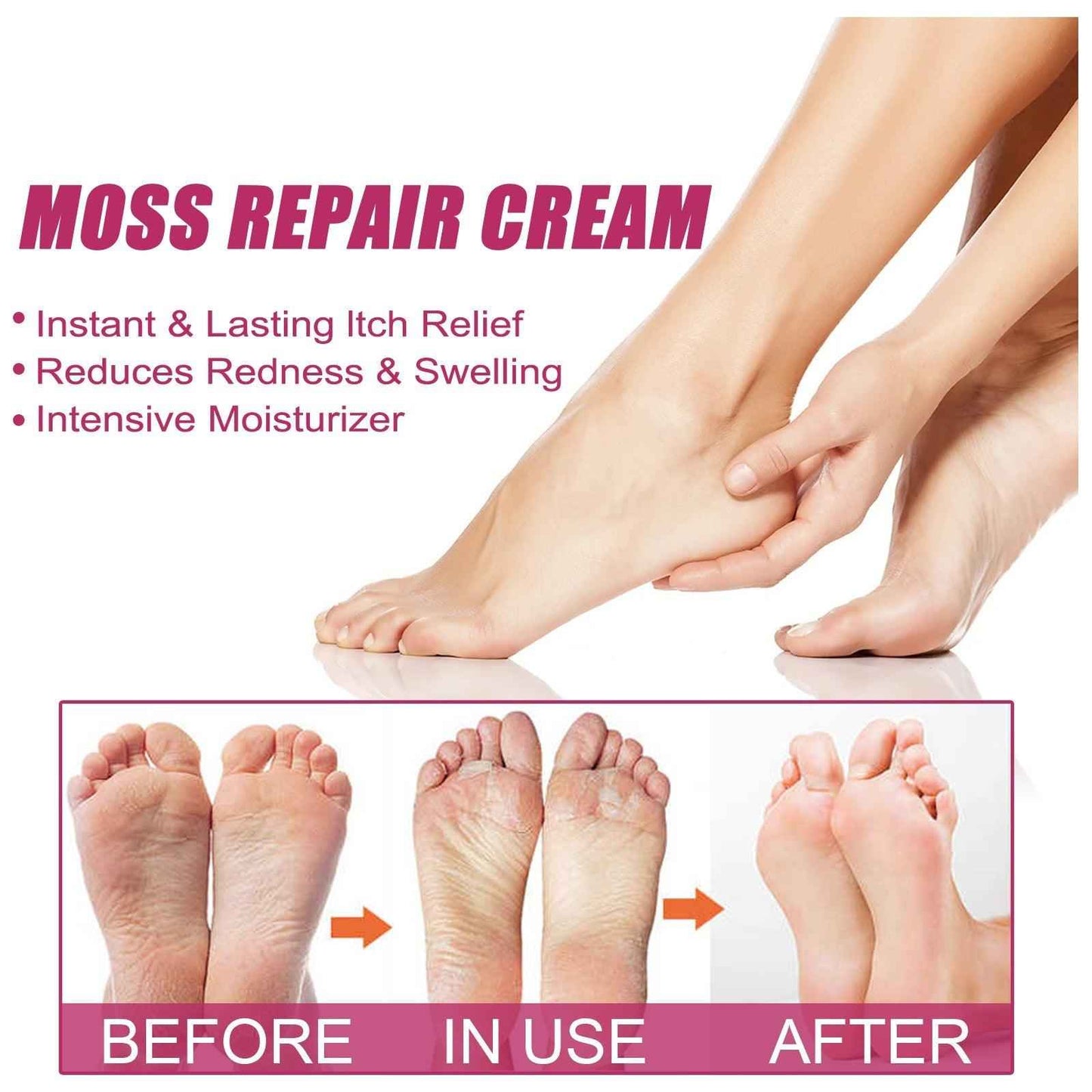 EELHOE Repair Cream Relieve Itching Body , Hands And Feet 50g