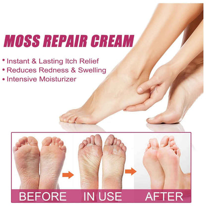 EELHOE Repair Cream Relieve Itching Body , Hands And Feet 50g