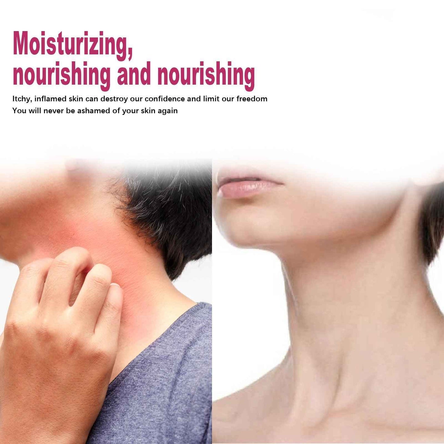 EELHOE Repair Cream Relieve Itching Body , Hands And Feet 50g