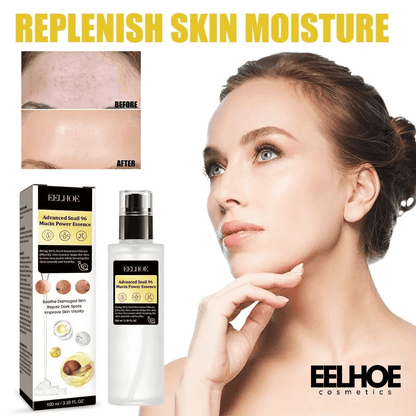 EELHOE Snail Mucin 96% Power Repairing Essence for Anti acne Dark Spots and Fine Lines 1pc EELHOE COSMETICS