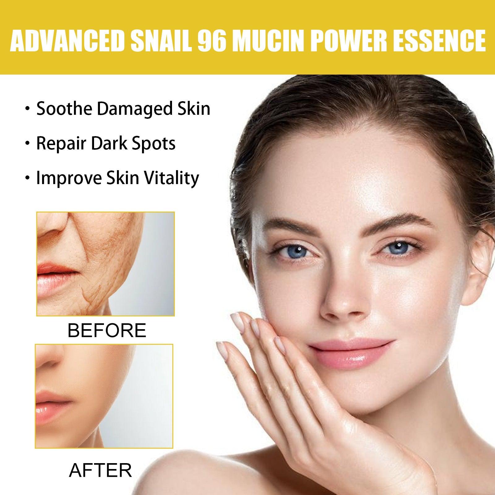 EELHOE Snail Mucin 96% Power Repairing Essence for Anti acne Dark Spots and Fine Lines