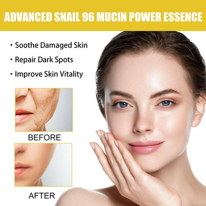 EELHOE Snail Mucin 96% Power Repairing Essence for Anti acne Dark Spots and Fine Lines EELHOE COSMETICS