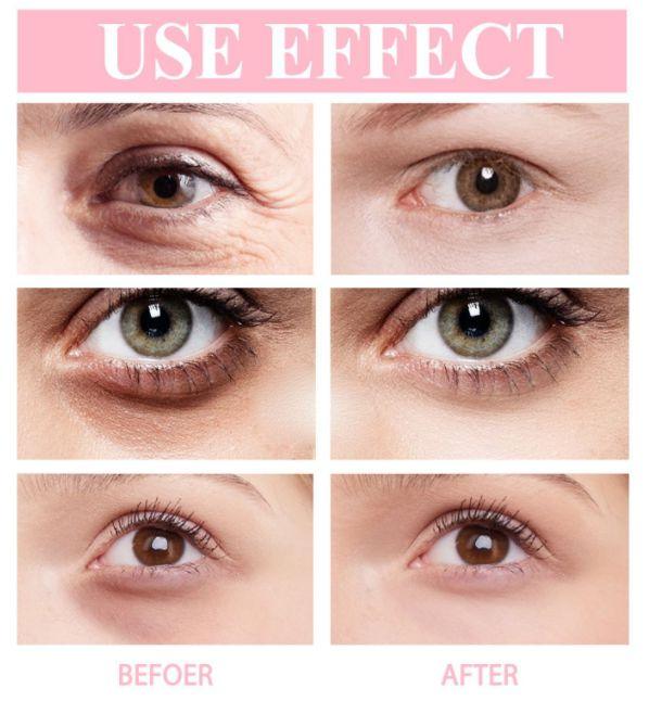Retinol E Eye Cream, Moisturizing Face Lifting Balm, Anti-Puffiness, Remove Dark Circles and Bags Under Eyes