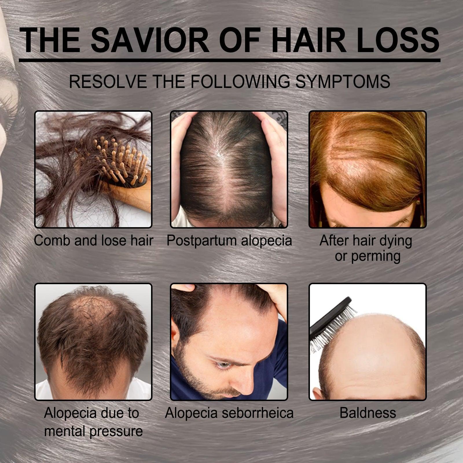 Rosemary Baby Hair Growth + Anti-Breakage Nourishing Essential Oil Hair 30ML EELHOE COSMETICS 30ml